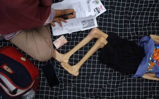 Viral! Diagnosis Usus Buntu RI vs Malaysia, Kemenkes Akhirnya Buka Suara